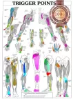 TRIGGER POINTS PART 2 ANATOMICAL DIAGRAM CHART ANATOMY PRINT PREMIUM POSTER