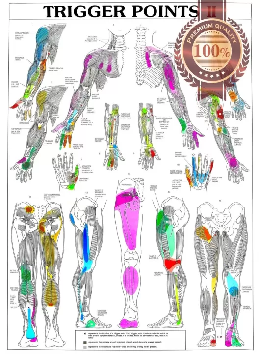 TRIGGER POINTS PART 2 ANATOMICAL DIAGRAM CHART ANATOMY PRINT PREMIUM POSTER