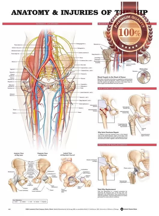 ANATOMY AND INJURIES OF THE HIPS DIAGRAM CHART GUIDE PRINT PREMIUM POSTER