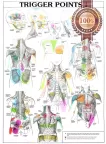 TRIGGER POINTS PART 1 ANATOMICAL DIAGRAM CHART ANATOMY PRINT PREMIUM POSTER