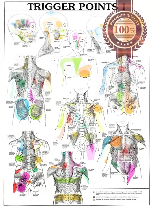 TRIGGER POINTS PART 1 ANATOMICAL DIAGRAM CHART ANATOMY PRINT PREMIUM POSTER