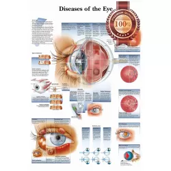 DISEASES OF THE HUMAN EYE INFOMATIONAL CHART DIAGRAM PRINT PREMIUM POSTER