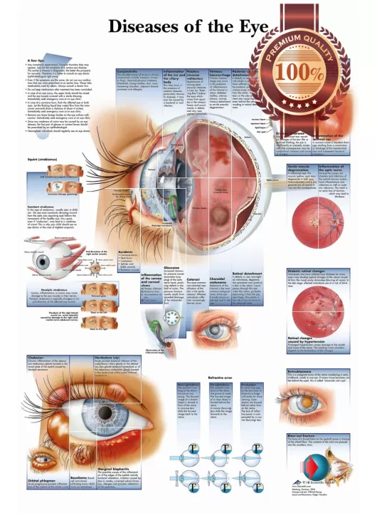DISEASES OF THE HUMAN EYE INFOMATIONAL CHART DIAGRAM PRINT PREMIUM POSTER