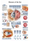 DISEASES OF THE HUMAN EYE INFOMATIONAL CHART DIAGRAM PRINT PREMIUM POSTER